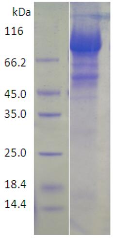 15% SDS-PAGE analysis profiles of purified KP1_4356-35-790 (CBB stained).